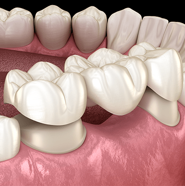 Treatment - cathedraldental