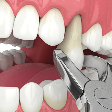 Treatment - cathedraldental