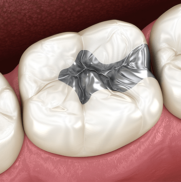 Treatment - cathedraldental