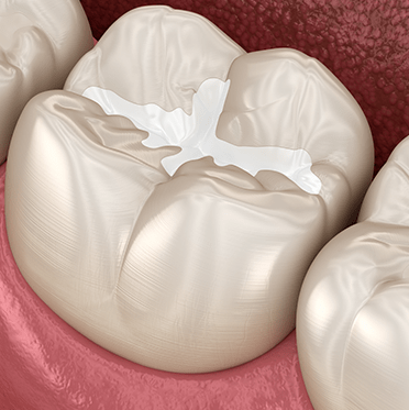 Treatment - cathedraldental