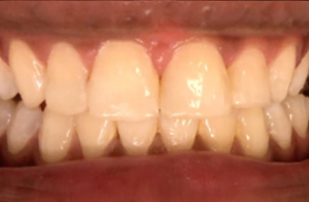 After - Maida Vale Dental Practice