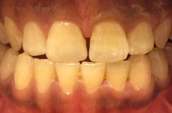 Before - Maida Vale Dental Practice