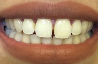 Before - Maida Vale Dental Practice