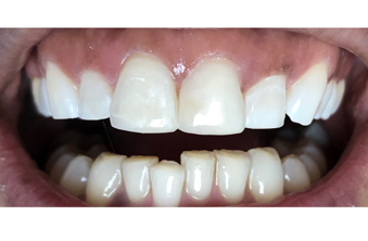 After - Maida Vale Dental Practice