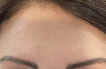 After - Maida Vale Dental Practice