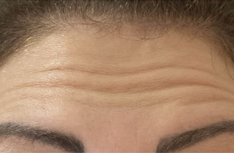 Before - Maida Vale Dental Practice