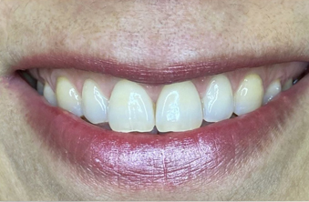 After - Maida Vale Dental Practice