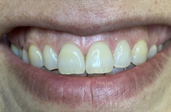 Before - Maida Vale Dental Practice