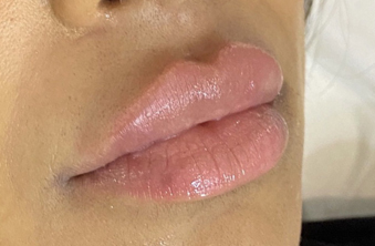 After - Maida Vale Dental Practice