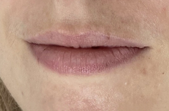 Before - Maida Vale Dental Practice