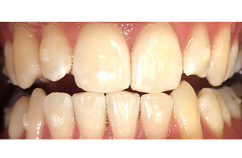 Before - Maida Vale Dental Practice