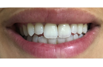 Before - Maida Vale Dental Practice