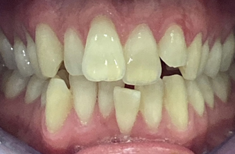 Before - Maida Vale Dental Practice