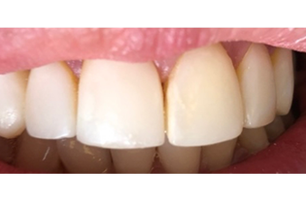 After - Maida Vale Dental Practice