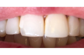 Before - Maida Vale Dental Practice