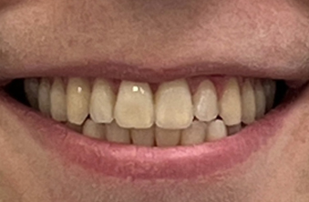 After - Maida Vale Dental Practice