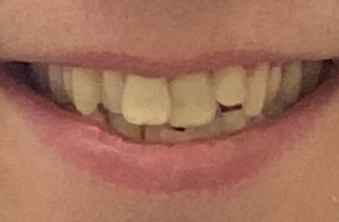 Before - Maida Vale Dental Practice