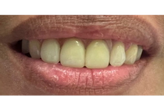 After - Maida Vale Dental Practice